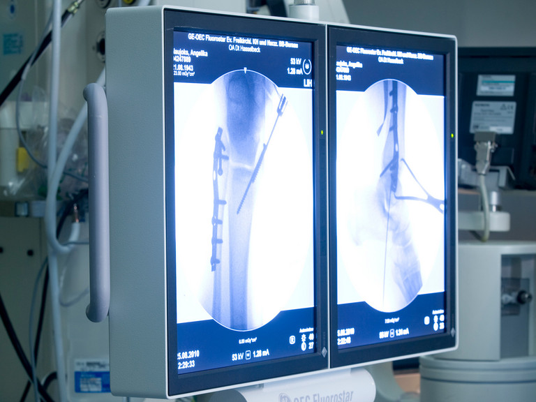 Röntgenbilder - Immanuel Klinikum Bernau - Unfallchirurgie